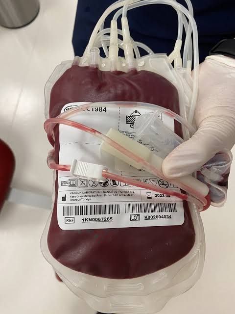 مويلحي يوجّه مراسلة عاجلة لوزارة الصحة بشأن نقص أكياس التبرع بالدم بالطارف وعنابة